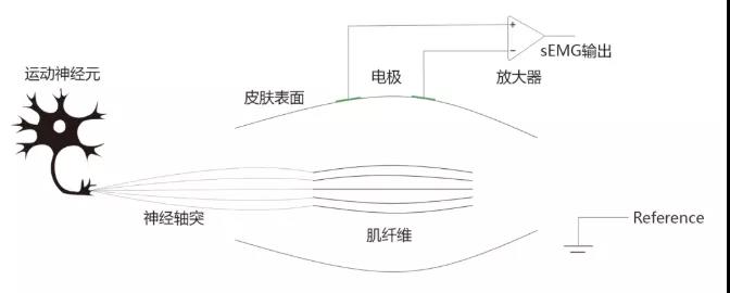 针极肌电图