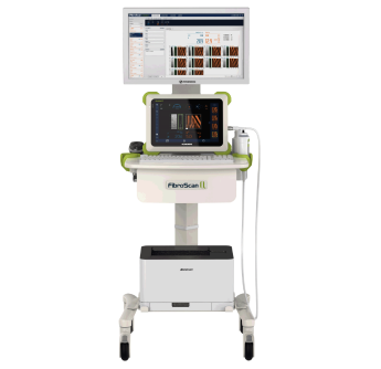 回波肝脏瞬时弹性检测仪fibroscan Q